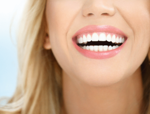 Dental Crowns vs. Veneers: Which Is Right for Your Smile?