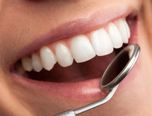 How to Fix a Chipped Tooth: Fast Solutions and What to Expect